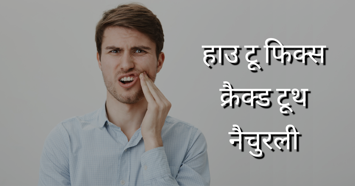 हाउ टू फिक्स क्रैक्ड टूथ नैचुरली